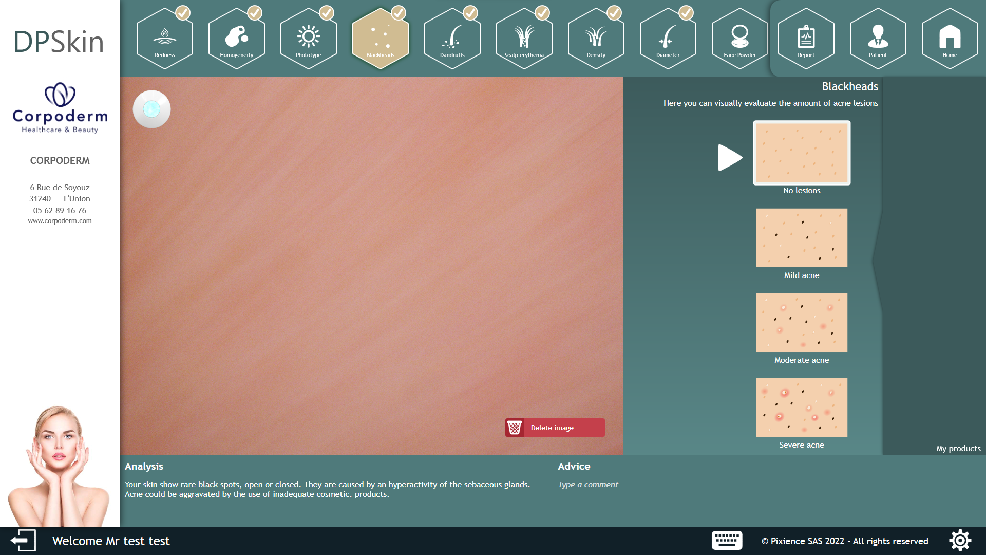 pasos de análisis de la piel hidratación con dp skin6